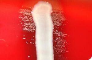 Granulicatella spp