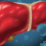 Hepatitis por citomegalovirus. Importancia del momento de contagio