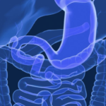 Perfil clínico y evolutivo de la enfermedad de Crohn en el Hospital Rebagliati (Lima-Perú)