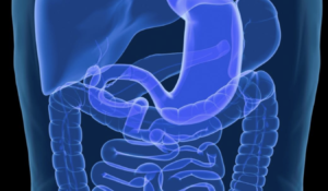 Perfil clínico y evolutivo de la enfermedad de Crohn en el Hospital Rebagliati (Lima-Perú)