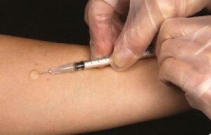 Prueba de tuberculina en trabajadores de la salud de Bogotá