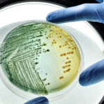 Infecciones Urinarias Complicadas