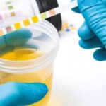 Proteinuria y microalbuminuria