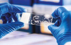 Guantes, guantes adicionales o guantes especiales para la prevención de exposiciones percutáneas en personal sanitario