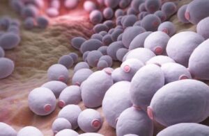Frecuencia del género Candida en vagina de mujeres en edad reproductiva