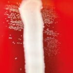Evaluación de la susceptibilidad directa desde hemocultivos positivos utilizando el sistema Vitek 2: comparación de dos protocolos rápidos