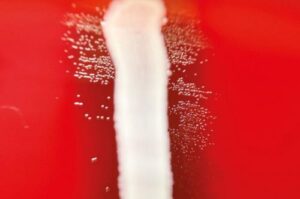 Evaluación de la susceptibilidad directa desde hemocultivos positivos utilizando el sistema Vitek 2: comparación de dos protocolos rápidos