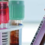 La medición de lípidos en estado postprandial representa mejor nuestros hábitos