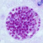 Técnica de Sedimentación Espontánea en Tubo para Diagnóstico de Enteroparasitosis en Centros de Salud de Primer Nivel