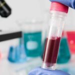 Sistemas de gestión de calidad aplicada a áreas de química clínica y hematología: ISO 9001:2015