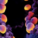 Staphylococcus aureus portador del gen mecA sensible a oxacilina (OS-MRSA): otro desafío para los laboratorios de microbiología