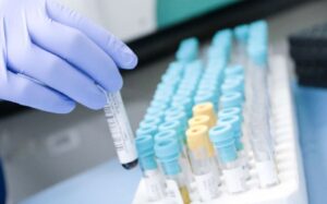 Tipos de residuos hospitalarios; forma de eliminación de los residuos hospitalarios