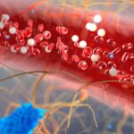Anemia hemolítica autoinmune por anticuerpos calientes secundaria a hipertiroidismo. Revisión de la literatura