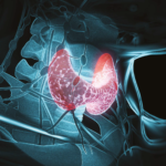 Se conoce como hipotiroidismo a una disfunción de la glándula tiroides, que es la encargada de secretar hormonas reguladoras del metabolismo1–3. Cuando existe baja producción de estas hormonas que son la T3 y T4, la hipófisis aumentará la producción de TSH (Hormona Estimuladora de Tiroides) intentando llevar la producción de T3 y T4 a valores que permitan el correcto desempeño del metabolismo.1,2,4