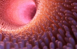 Biomarcadores en enfermedad inflamatoria intestinal: ¿sabe cómo utilizarlos?