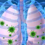 Factores Pronóstico de Neumonía Grave Comunitaria en Unidad de Terapia Intensiva Pediátrica. Bayamo. 2016-2019