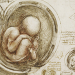 Diagnóstico prenatal de malformaciones congénitas y alteraciones cromosómicas: resultado de la experiencia CIMAF - Hospital Dr. Sótero Del Río ARTÍCULO DE INVESTIGACIÓN