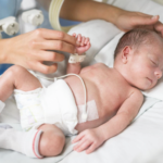 Injuria Renal Aguda Neonatal ARTÍCULO EN REVISIÓN