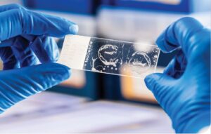 Normas de Bioseguridad para el Laboratorio de Microbiología