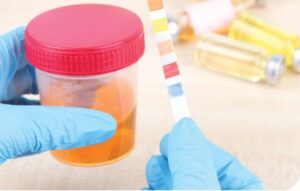 Significado de la proteinuria en el niño y adolescente. Consenso