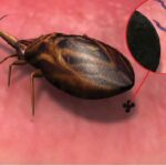 Comparación de siete pruebas diagnósticas para detectar infección por Trypanosoma cruzi en pacientes en fase crónica de la enfermedad de Chagas