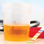 Validación del método enzimático para la determinación de creatinina en suero y orina