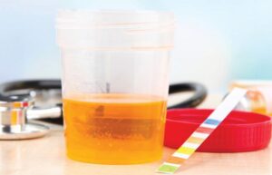 Validación del método enzimático para la determinación de creatinina en suero y orina