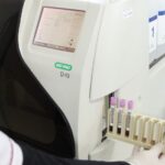 Hemoglobina Glicosilada por HPLC