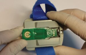 Test del Sudor Tecil Diagnóstico Definitivo de Fibrosis Quística: ISEsweat