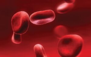 Síndrome hemofagocítico adquirido: reporte de casos de cuatro pacientes adultos tratados con protocolo HLH 94-04 y revisión de la literatura