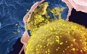 Transmisión parenteral del Virus Linfotrópico T Humano Tipo 1: ¿es un factor de riesgo a considerar para el desarrollo de la leucemia a Células T del adulto?