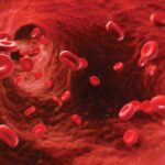 Anemia Hemolítica Autoinmune mediada por IgG, E e IgA en un paciente con colitis ulcerativa. Caso Clínico
