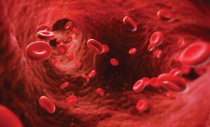 Anemia Hemolítica Autoinmune mediada por IgG, E e IgA en un paciente con colitis ulcerativa. Caso Clínico