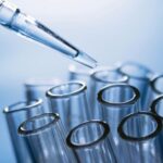 ADENOSINA DEAMINASA (ADA). La importancia de su diagnóstico en los laboratorios