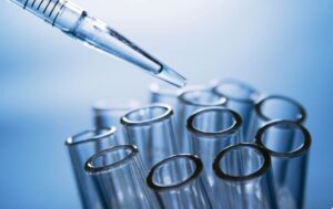 ADENOSINA DEAMINASA (ADA). La importancia de su diagnóstico en los laboratorios