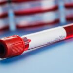 La sistematización, una experiencia en hematología