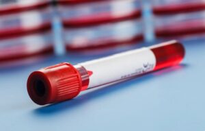 La sistematización, una experiencia en hematología