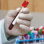 Nuevas pruebas diagnósticas en paneles sindrómicos