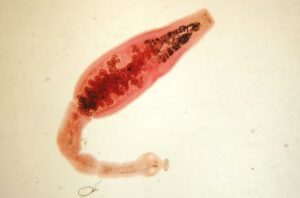 Diagnóstico, tratamiento y seguimiento de la hidatidosis