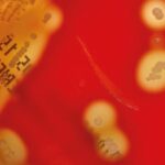 Detección de la colonización asintomática en orofaringe por Streptococcus pyogenes mediante dos métodos diagnósticos