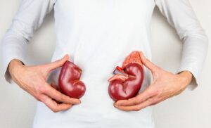 “Correlación entre la disminución de la función renal en pacientes diagnosticados con Leucemia Mieloide Crónica en fase crónica tratados con Imatinib y el número de copias del gen de fusión BCR-ABL1 al momento del diagnóstico”