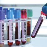 Sistema de Gestión de la Calidad para Laboratorios Clínicos Privados de Venezuela bajo la Norma Internacional ISO 15189:2012