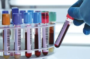 Sistema de Gestión de la Calidad para Laboratorios Clínicos Privados de Venezuela bajo la Norma Internacional ISO 15189:2012