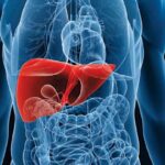 Calibración y validación de la Razón Internacional Normatizada (RIN) en pacientes cirróticos
