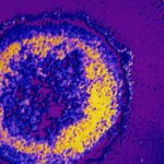 Aspectos inmunológicos en pacientes con VIH y terapia antirretroviral