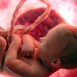Comparación de la eficacia de la ?-microglobulina-1 placentaria vs cristalografía en factores que modifican el resultado