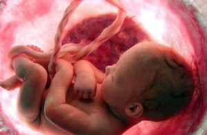 Comparación de la eficacia de la ?-microglobulina-1 placentaria vs cristalografía en factores que modifican el resultado