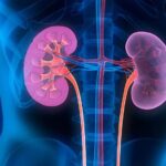 Toxinas unidas a proteínas: valor añadido en su eliminación con altos volúmenes convectivos