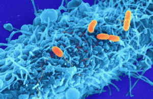 Efectividad del sistema de puntuación de Nugent en el diagnóstico de vaginosis bacteriana