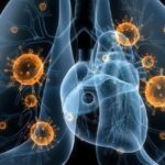 Asociación de los biomarcadores con el cáncer pulmonar en pacientes de un servicio de neumología